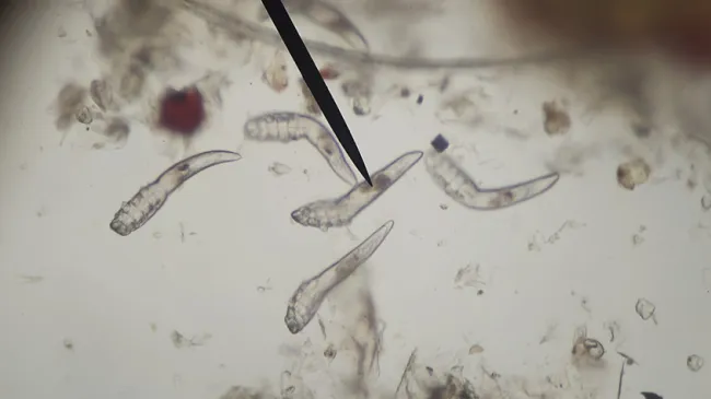 Examen parazitologic cutanat (Demodex folliculorul şi brevis)