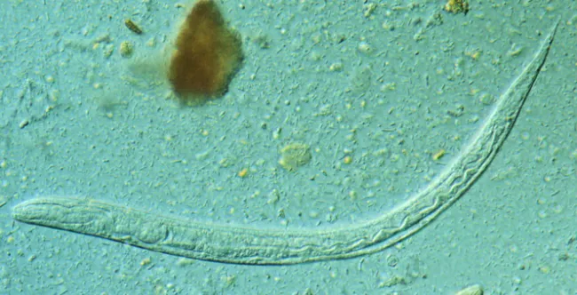 Paraziţi: Strongyloides stercoralis