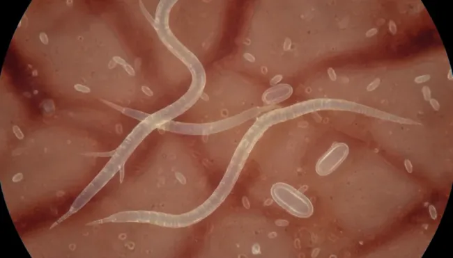 Paraziţi: Enterobius vermicularis
